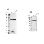 ME2 Antibody in Western Blot (WB)