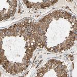 Ribophorin II Antibody in Immunohistochemistry (Paraffin) (IHC (P))