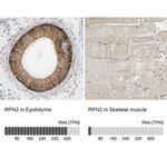 Ribophorin II Antibody