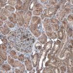 HMGCR Antibody in Immunohistochemistry (IHC)