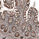 HMGCR Antibody in Immunohistochemistry (IHC)