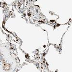 LTA4H Antibody in Immunohistochemistry (Paraffin) (IHC (P))