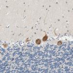 GPSM2 Antibody in Immunohistochemistry (Paraffin) (IHC (P))