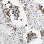 CKAP2 Antibody in Immunohistochemistry (Paraffin) (IHC (P))