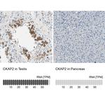 CKAP2 Antibody in Immunohistochemistry (IHC)