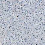 CKAP2 Antibody in Immunohistochemistry (IHC)