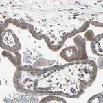 PANK2 Antibody in Immunohistochemistry (Paraffin) (IHC (P))