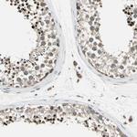 PANK2 Antibody in Immunohistochemistry (IHC)