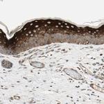 CCDC23 Antibody in Immunohistochemistry (IHC)