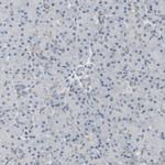 CCDC23 Antibody in Immunohistochemistry (IHC)