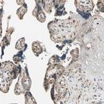 CCDC23 Antibody in Immunohistochemistry (IHC)