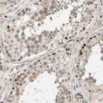 CCDC23 Antibody in Immunohistochemistry (IHC)