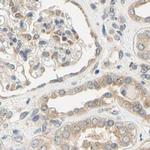 LRRC47 Antibody in Immunohistochemistry (IHC)