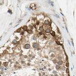 LRRC47 Antibody in Immunohistochemistry (IHC)