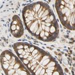 LRRC47 Antibody in Immunohistochemistry (IHC)