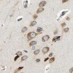 LRRC47 Antibody in Immunohistochemistry (IHC)