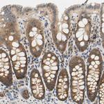 LRRC47 Antibody in Immunohistochemistry (IHC)