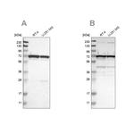 LRRC47 Antibody in Western Blot (WB)