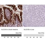 SLC51B Antibody in Immunohistochemistry (IHC)