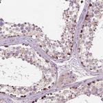 SLC51B Antibody in Immunohistochemistry (IHC)