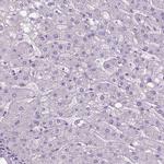 SLC51B Antibody in Immunohistochemistry (IHC)