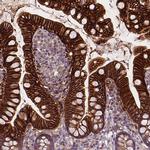 SLC51B Antibody in Immunohistochemistry (IHC)