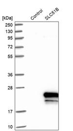 SLC51B Antibody in Western Blot (WB)