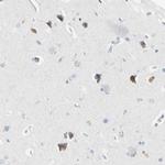 ECRG4 Antibody in Immunohistochemistry (Paraffin) (IHC (P))