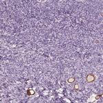 ZP4 Antibody in Immunohistochemistry (IHC)