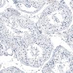 SLC22A2 Antibody in Immunohistochemistry (Paraffin) (IHC (P))