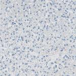 SLC22A2 Antibody in Immunohistochemistry (IHC)