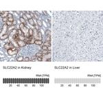 SLC22A2 Antibody