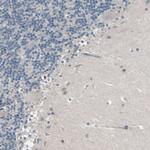 NMI Antibody in Immunohistochemistry (Paraffin) (IHC (P))