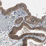 NMI Antibody in Immunohistochemistry (IHC)