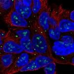 SLC6A15 Antibody in Immunocytochemistry (ICC/IF)