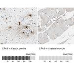 Carboxypeptidase A3 Antibody in Immunohistochemistry (IHC)