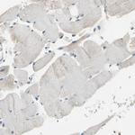 Carboxypeptidase A3 Antibody in Immunohistochemistry (IHC)