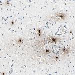 Carboxypeptidase A3 Antibody in Immunohistochemistry (IHC)