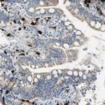 Carboxypeptidase A3 Antibody in Immunohistochemistry (IHC)