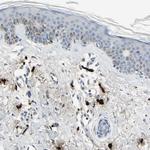 Carboxypeptidase A3 Antibody in Immunohistochemistry (IHC)