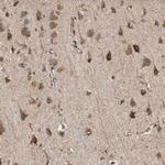 AKAP1 Antibody in Immunohistochemistry (Paraffin) (IHC (P))