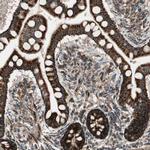 AKAP1 Antibody in Immunohistochemistry (Paraffin) (IHC (P))