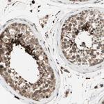 AKAP1 Antibody in Immunohistochemistry (Paraffin) (IHC (P))