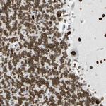 ZNF132 Antibody in Immunohistochemistry (Paraffin) (IHC (P))