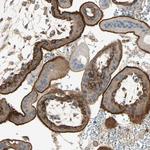 AGFG1 Antibody in Immunohistochemistry (Paraffin) (IHC (P))