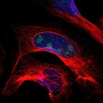 PITX1 Antibody in Immunocytochemistry (ICC/IF)