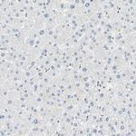 SMARCA5 Antibody in Immunohistochemistry (Paraffin) (IHC (P))