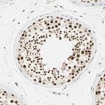 SMARCA5 Antibody in Immunohistochemistry (IHC)