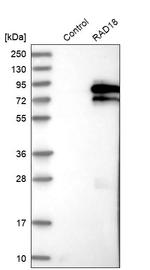 RAD18 Antibody in Western Blot (WB)