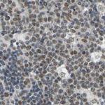 POGZ Antibody in Immunohistochemistry (IHC)